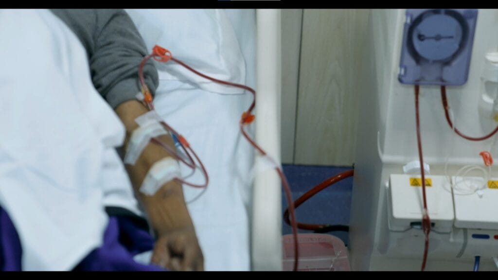 Dialysis